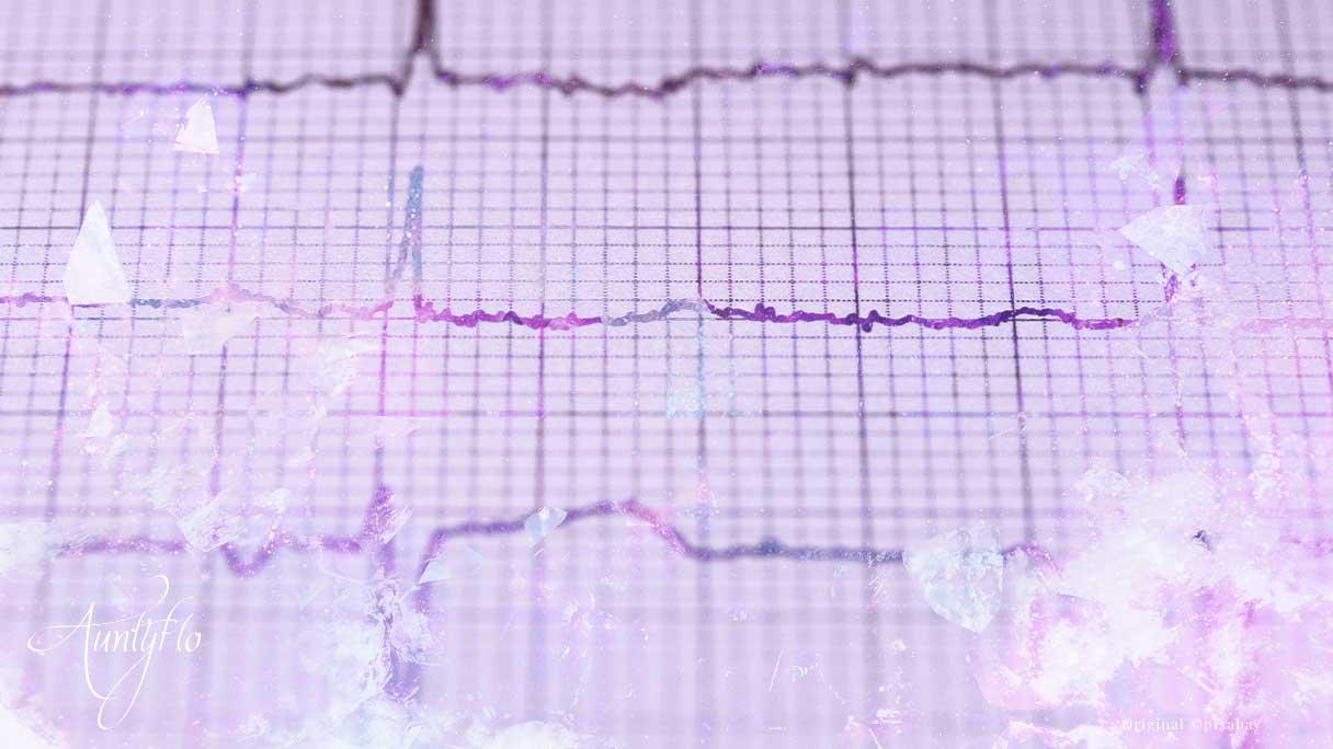 Woke Up from a Heart Attack Dream? Find Out What It Means Now